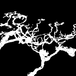 Segmented nerve image